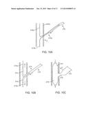 INTRAVASCULAR DEVICES SUPPORTING AN ARTERIOVENOUS FISTULA diagram and image