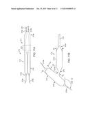 INTRAVASCULAR DEVICES SUPPORTING AN ARTERIOVENOUS FISTULA diagram and image