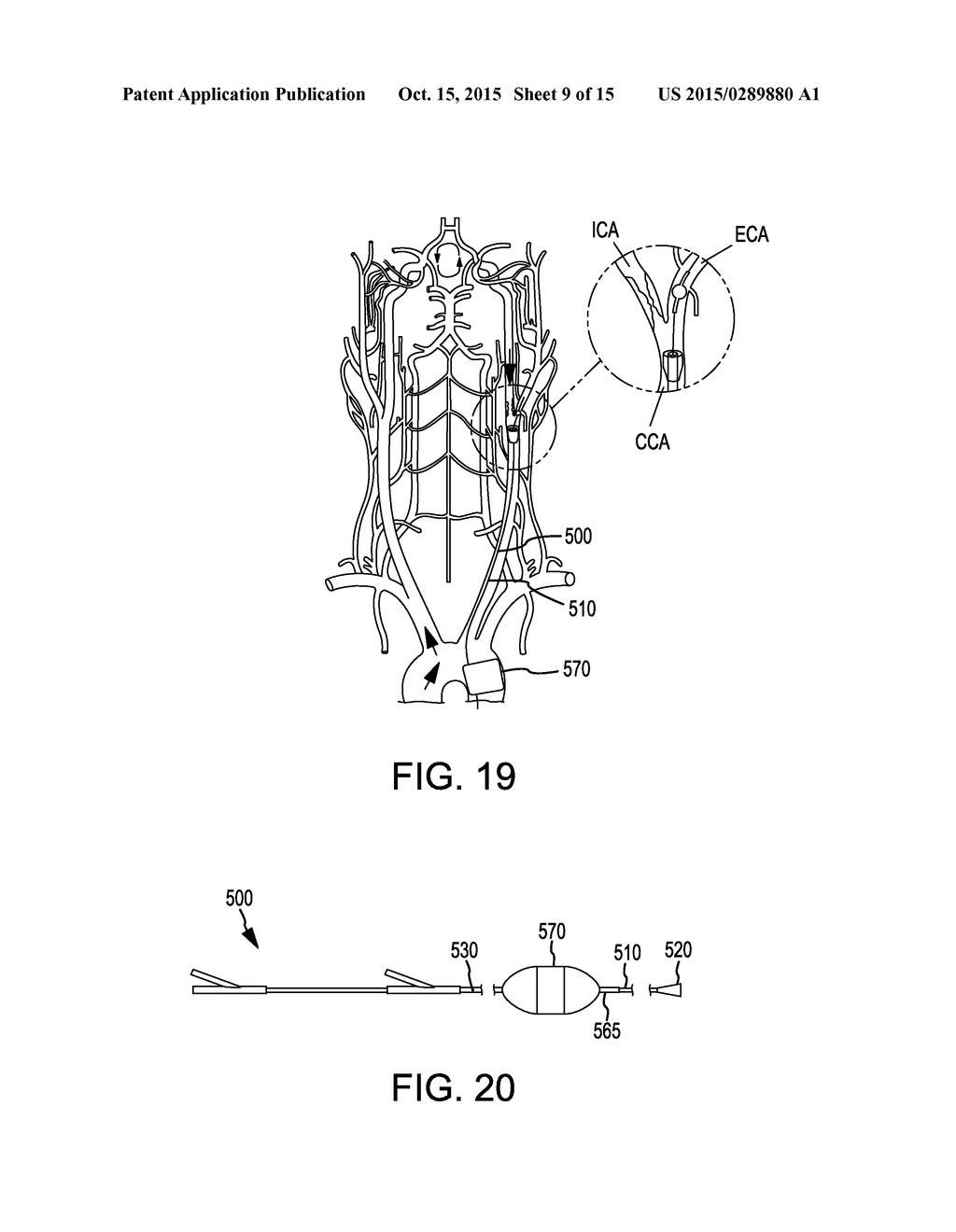 SINGLE ACCESS FLOW-REVERSAL CATHETER DEVICES AND METHODS - diagram, schematic, and image 10