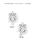 INTERVERTEBRAL PROSTHESIS ENDPLATE HAVING DOUBLE DOME AND SURGICAL TOOLS     FOR IMPLANTING SAME diagram and image