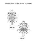 INTERVERTEBRAL PROSTHESIS ENDPLATE HAVING DOUBLE DOME AND SURGICAL TOOLS     FOR IMPLANTING SAME diagram and image