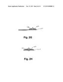 INTERVERTEBRAL PROSTHESIS ENDPLATE HAVING DOUBLE DOME AND SURGICAL TOOLS     FOR IMPLANTING SAME diagram and image