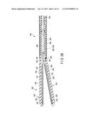 THERAPEUTIC TREATMENT DEVICE diagram and image