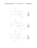 VENOUS ENDOLUMINAL DEVICES FOR THE TREATMENT OF DEFECTS OF VEINS diagram and image