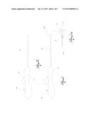 VENOUS ENDOLUMINAL DEVICES FOR THE TREATMENT OF DEFECTS OF VEINS diagram and image