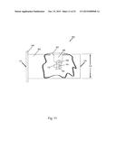 Arthroscopic Method and Apparatus for Rotator Cuff Repair diagram and image