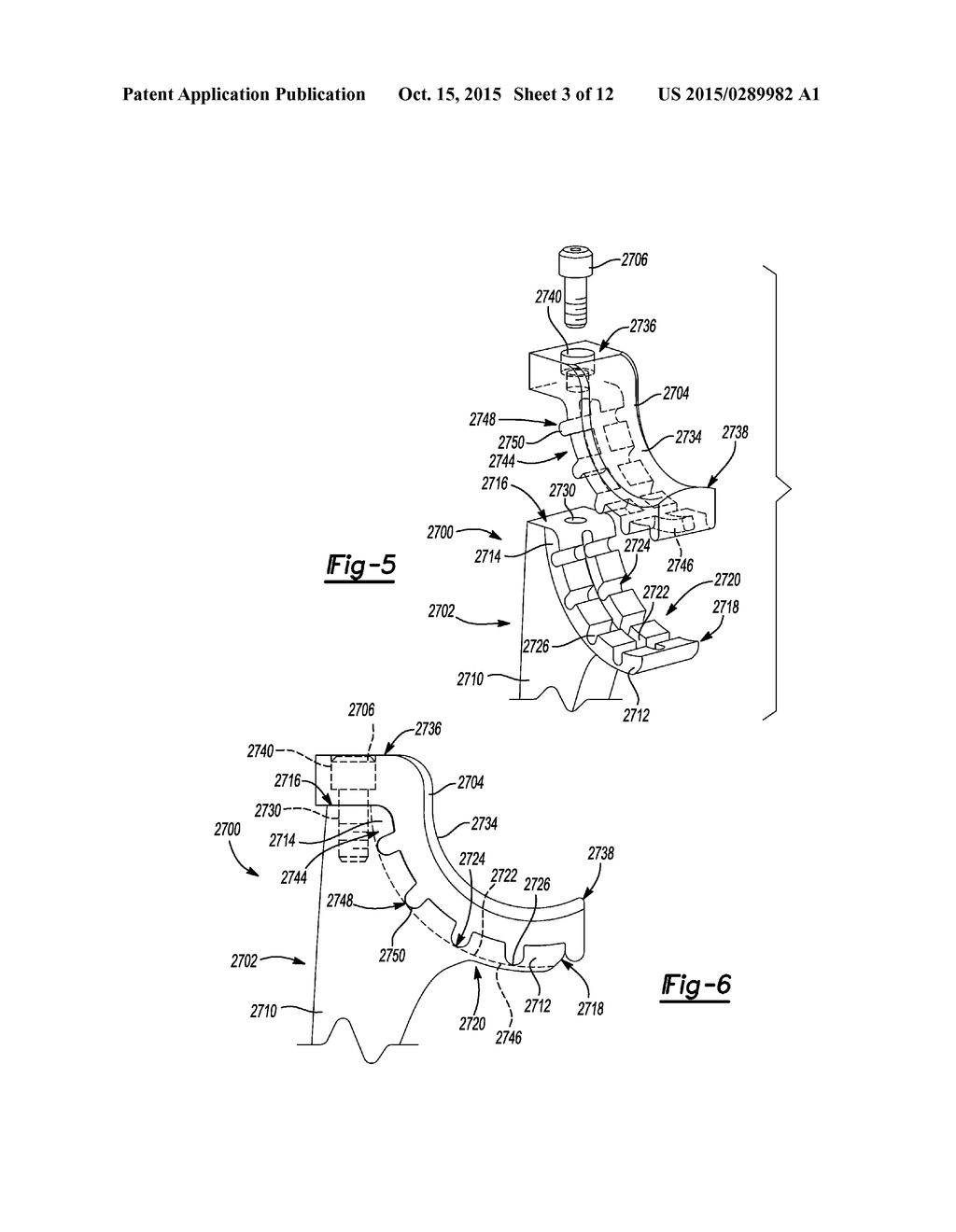 ELBOW PROSTHESIS - diagram, schematic, and image 04