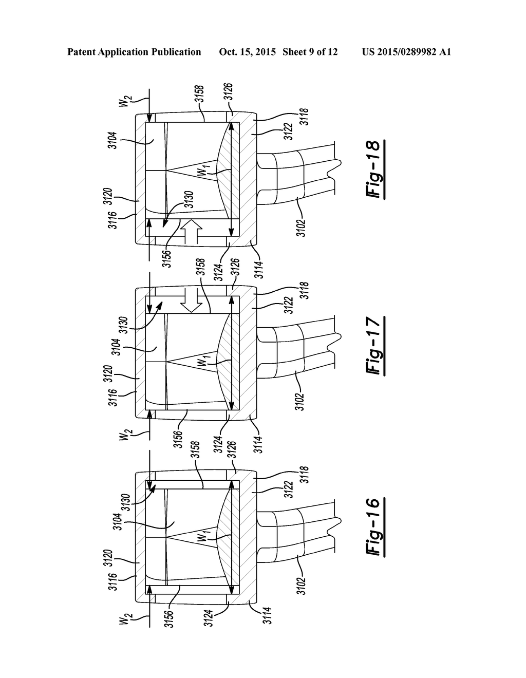 ELBOW PROSTHESIS - diagram, schematic, and image 10