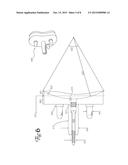 Total Shoulder Arthroplasty Prosthesis diagram and image