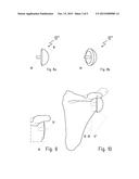 SHOULDER PROSTHESIS AND COMPONENTS THEREOF diagram and image