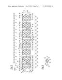 STENT diagram and image