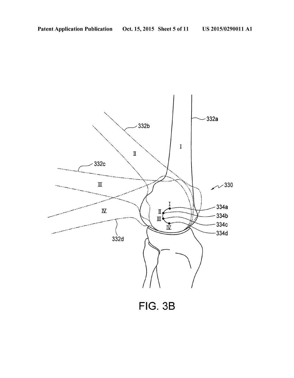 FLEXIBLE SUPPORT BRACE - diagram, schematic, and image 06