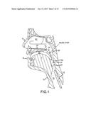 Non-Surgical Method and System for Reducing Snoring diagram and image