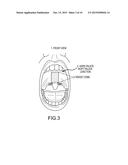 Non-Surgical Method and System for Reducing Snoring diagram and image