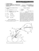 DELIVERING OCULAR IMPLANTS INTO THE EYE diagram and image