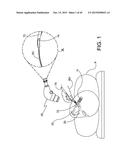 DELIVERING OCULAR IMPLANTS INTO THE EYE diagram and image