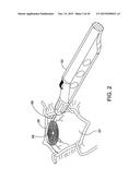 DELIVERING OCULAR IMPLANTS INTO THE EYE diagram and image