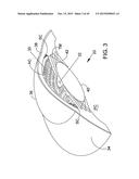 DELIVERING OCULAR IMPLANTS INTO THE EYE diagram and image