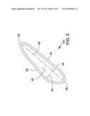 DELIVERING OCULAR IMPLANTS INTO THE EYE diagram and image