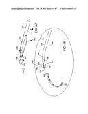 DELIVERING OCULAR IMPLANTS INTO THE EYE diagram and image