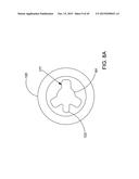 DELIVERING OCULAR IMPLANTS INTO THE EYE diagram and image