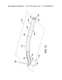 DELIVERING OCULAR IMPLANTS INTO THE EYE diagram and image