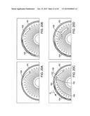 DELIVERING OCULAR IMPLANTS INTO THE EYE diagram and image