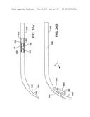 DELIVERING OCULAR IMPLANTS INTO THE EYE diagram and image