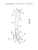 DELIVERING OCULAR IMPLANTS INTO THE EYE diagram and image