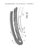 DELIVERING OCULAR IMPLANTS INTO THE EYE diagram and image