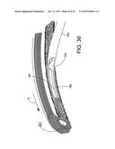 DELIVERING OCULAR IMPLANTS INTO THE EYE diagram and image