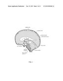 Use of TRPV4 Antagonists to Ameliorate Hydrocephalus and Related Materials     and Methods diagram and image