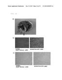 THERAPEUTIC AGENT FOR ISCHEMIC DISEASES diagram and image