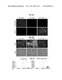 METHODS OF TREATING MUSCULAR DYSTROPHY diagram and image