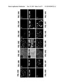 METHODS OF TREATING MUSCULAR DYSTROPHY diagram and image