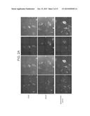 ANGIOGENIC CONDITIONING TO ENHANCE CARDIAC CELLULAR REPROGRAMMING OF     FIBROBLASTS OF THE INFARCTED MYOCARDIUM diagram and image