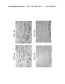 ANGIOGENIC CONDITIONING TO ENHANCE CARDIAC CELLULAR REPROGRAMMING OF     FIBROBLASTS OF THE INFARCTED MYOCARDIUM diagram and image