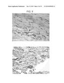 ANGIOGENIC CONDITIONING TO ENHANCE CARDIAC CELLULAR REPROGRAMMING OF     FIBROBLASTS OF THE INFARCTED MYOCARDIUM diagram and image