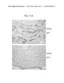 ANGIOGENIC CONDITIONING TO ENHANCE CARDIAC CELLULAR REPROGRAMMING OF     FIBROBLASTS OF THE INFARCTED MYOCARDIUM diagram and image