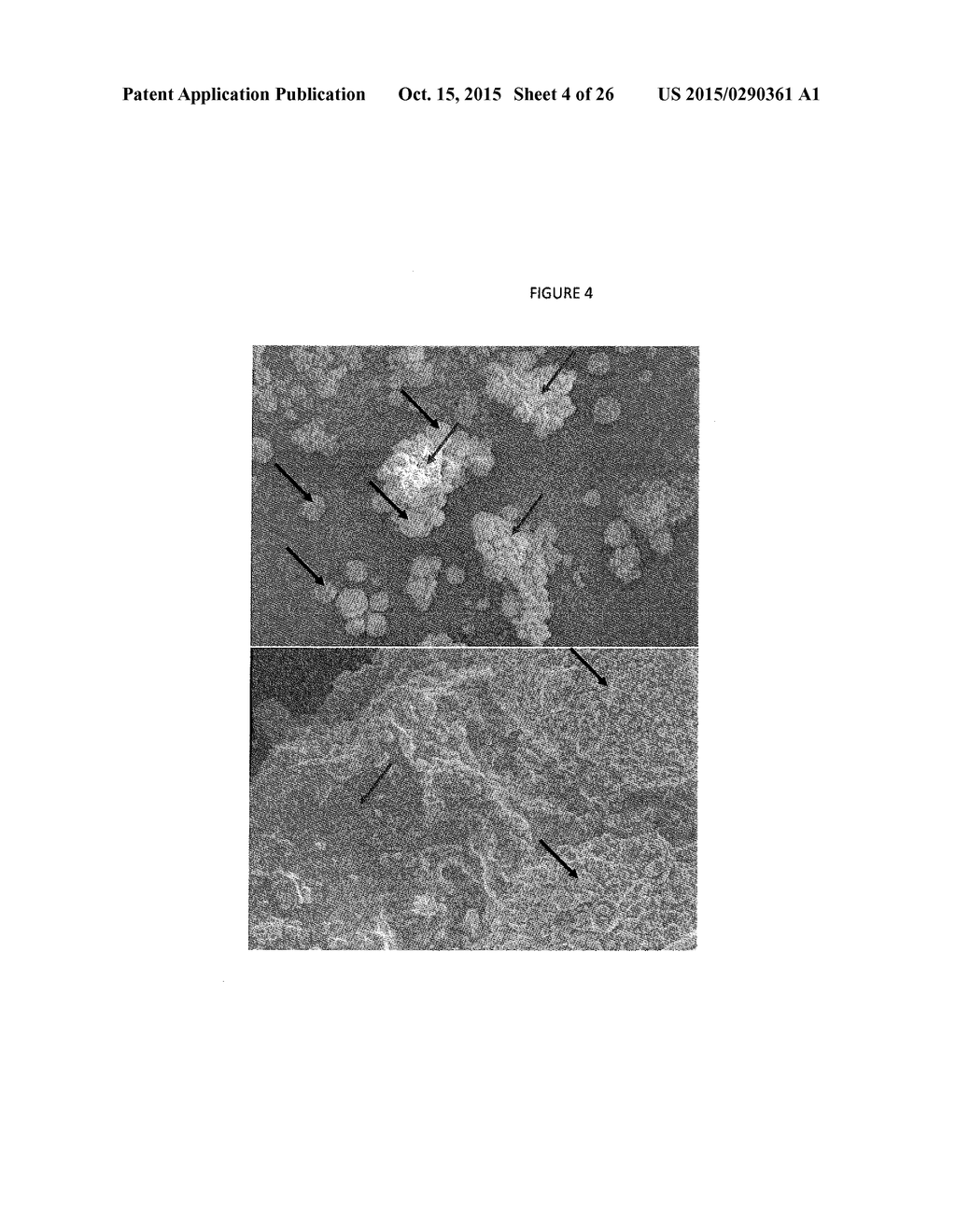 Small molecule drug release from in situ forming degradable scaffolds     incorporating hydrogels and bioceramic microparticles - diagram, schematic, and image 05