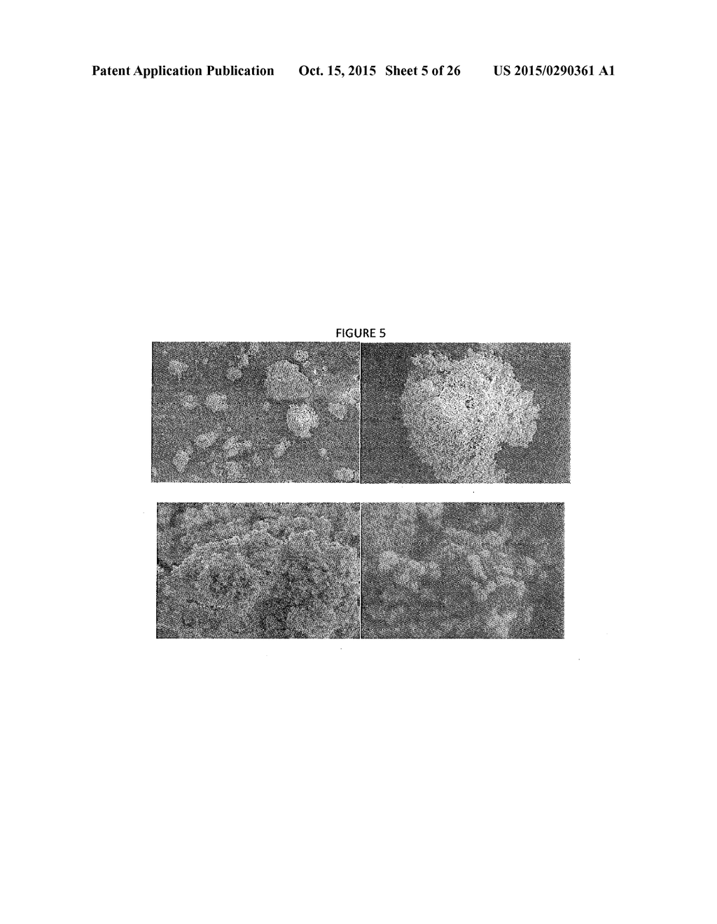 Small molecule drug release from in situ forming degradable scaffolds     incorporating hydrogels and bioceramic microparticles - diagram, schematic, and image 06