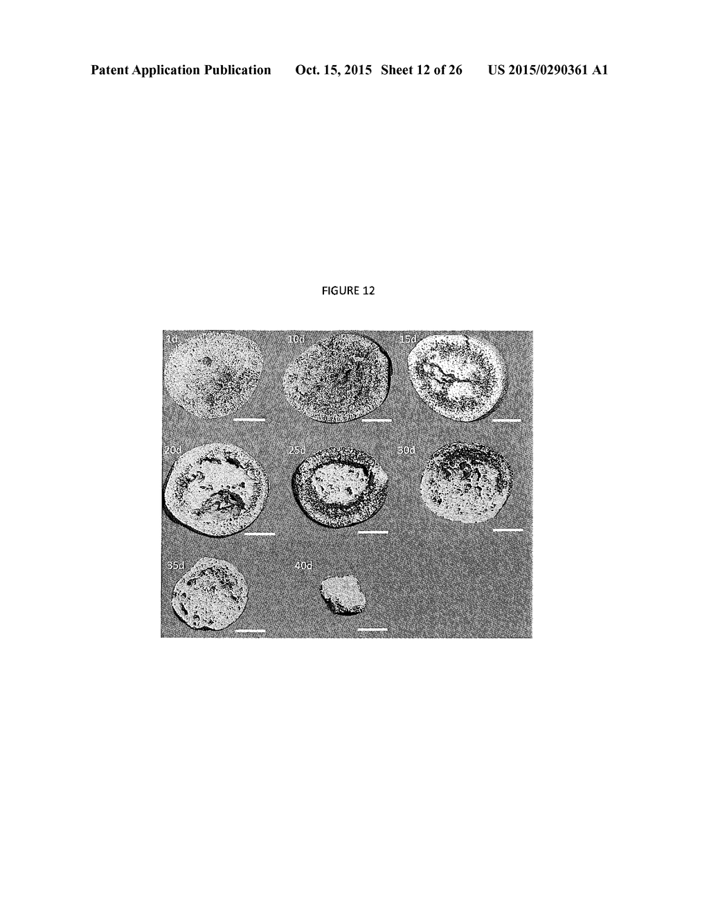 Small molecule drug release from in situ forming degradable scaffolds     incorporating hydrogels and bioceramic microparticles - diagram, schematic, and image 13