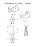 Guidance Device for Mating a Guidewire to a Medical Device diagram and image