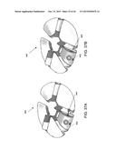 LIGHT THERAPY BANDAGE SYSTEM diagram and image