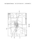 BLOOD-TISSUE SURFACE BASED RADIOSURGICAL RENAL TREATMENT PLANNING diagram and image