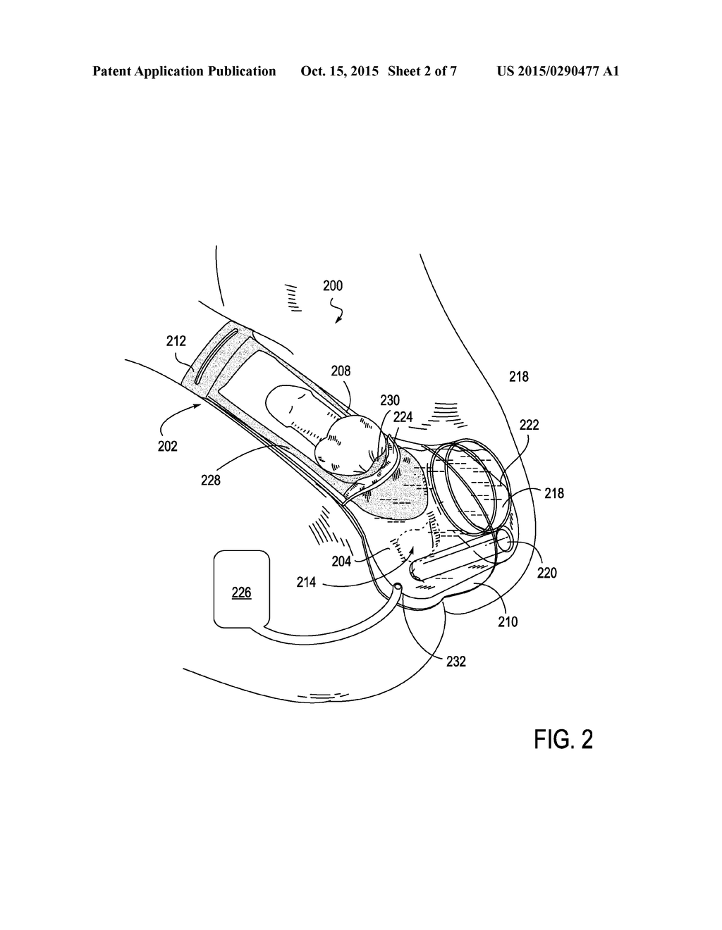 DISPOSABLE ACOUSTIC COUPLING MEDIUM CONTAINER - diagram, schematic, and image 03