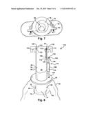 CONTAINER, SYSTEM, AND METHOD FOR COLLECTING MEDICAL WASTE diagram and image