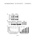 NATURAL-KILLER/T-CELL LYMPHOMA (NKTCL) SUSCEPTIBILITY PREDICTION,     DIAGNOSIS AND THERAPY diagram and image