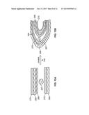 Pliable Pressure-Sensing Fabric diagram and image