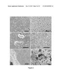 EXTRACELLULAR MATRIX PROTEINS FROM HAEMOPHILUS INFLUENZAE BIOFILMS:     TARGETS FOR THERAPEUTIC OR DIAGNOSTIC USE diagram and image